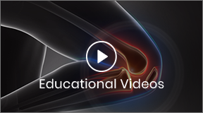Patient Educational Video