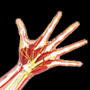 Sports Injury Management of Hand, Wrist & Elbow